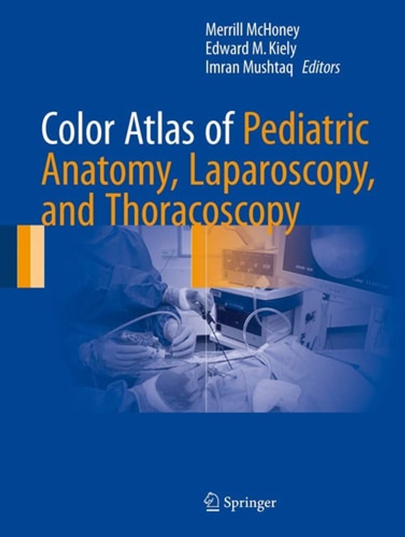 coverImage