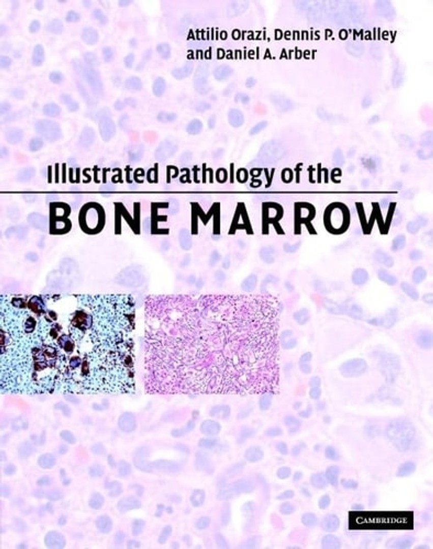 coverImage