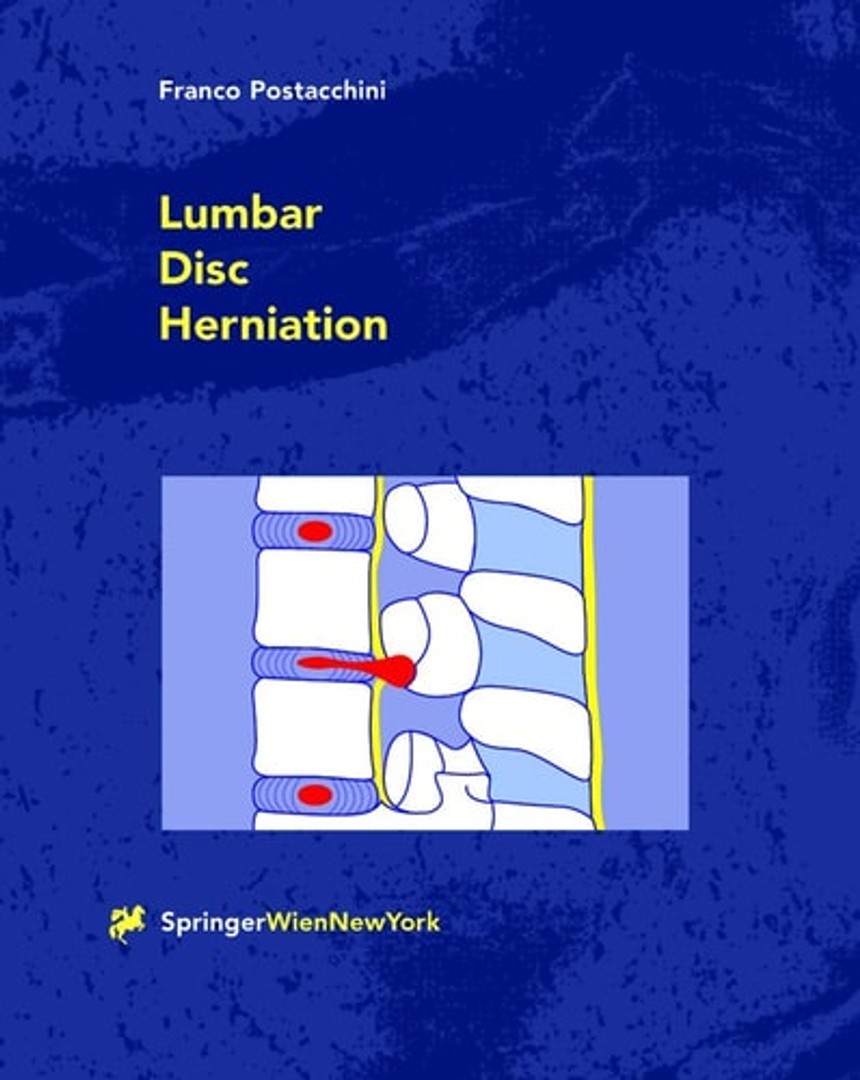 coverImage
