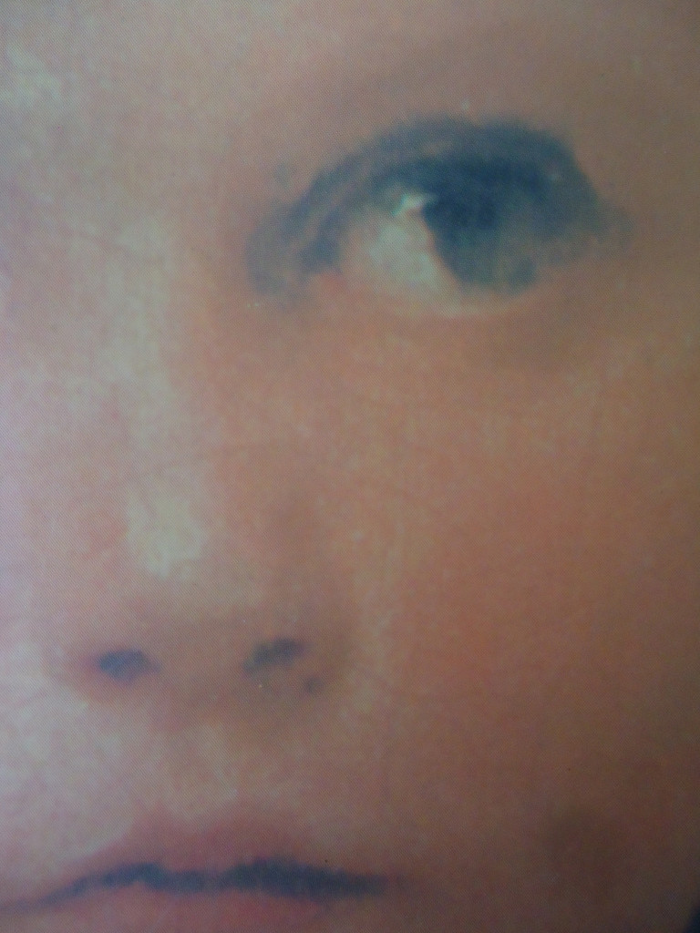 coverImage