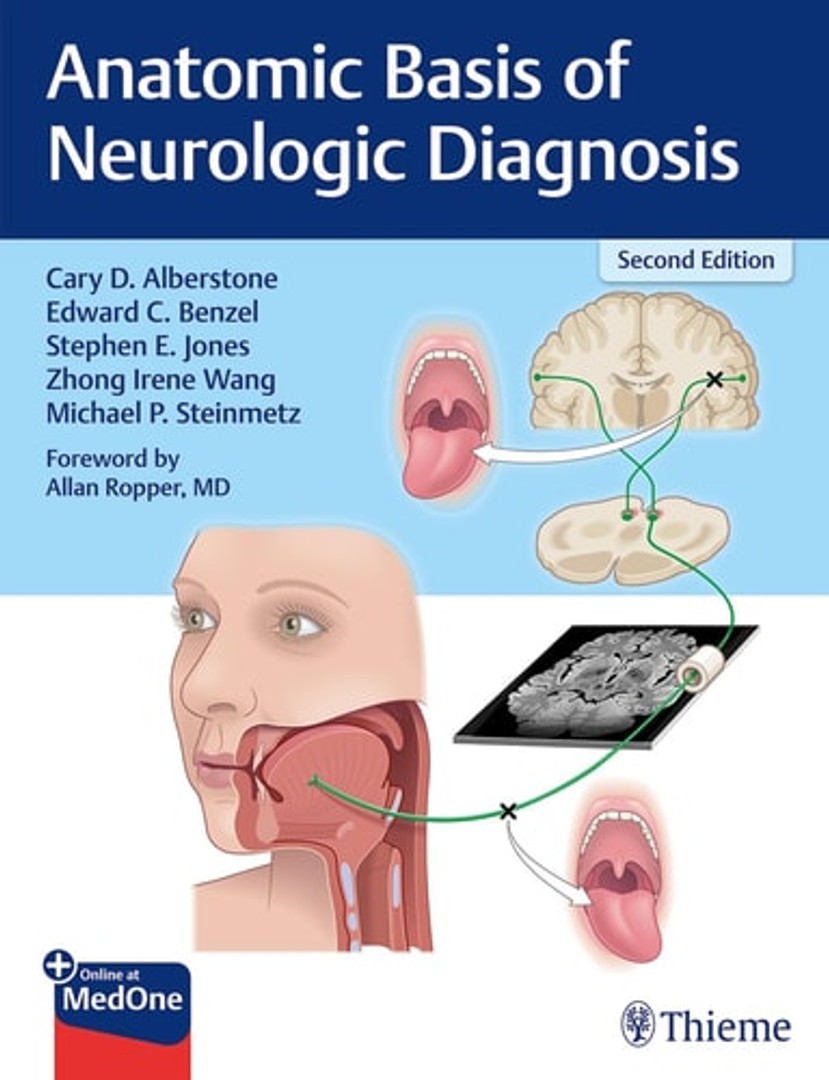 coverImage