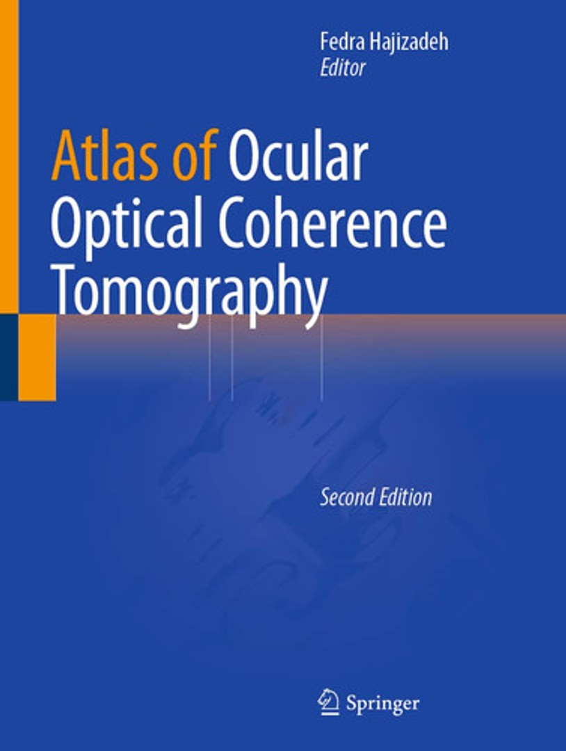 coverImage