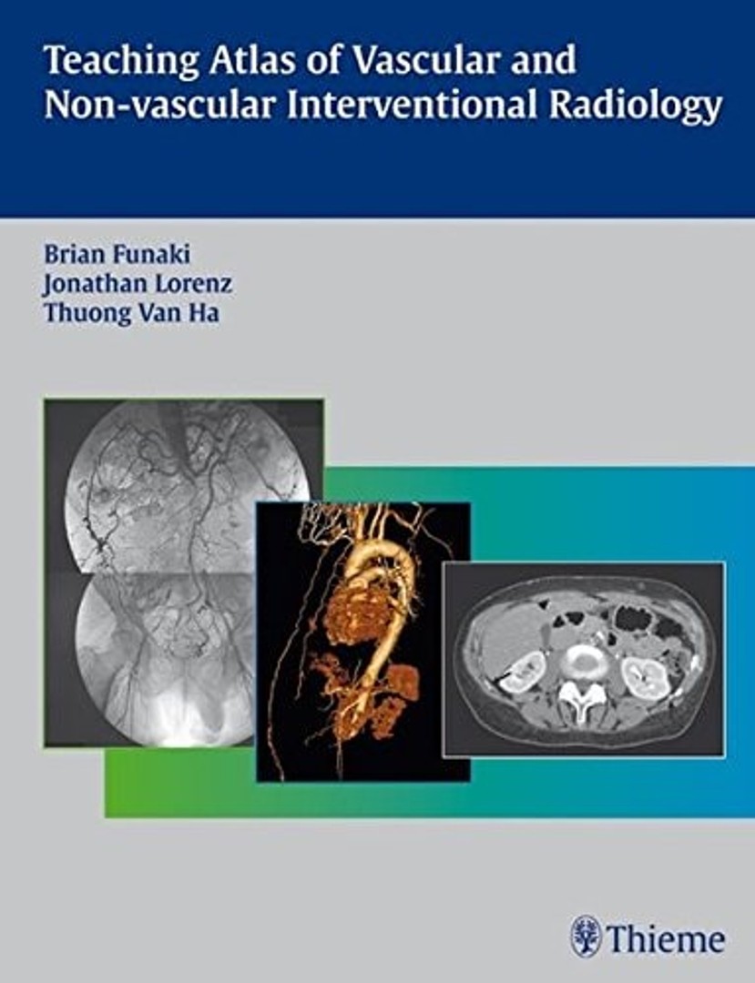 coverImage